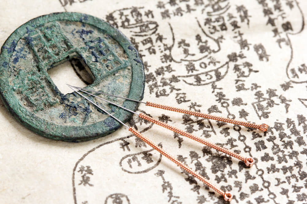 Chinese acupunture needles.